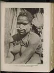Frau aus Neu-Guinea, zum Zeichen der Trauer mit Lehm beschmiert